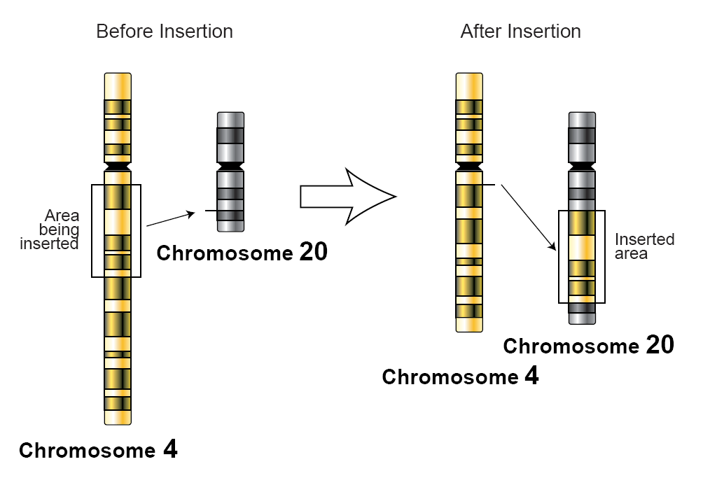 Insertion (genetics) - Wikipedia