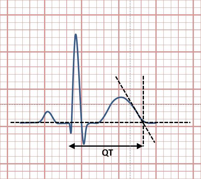 QT interval - Wikipedia