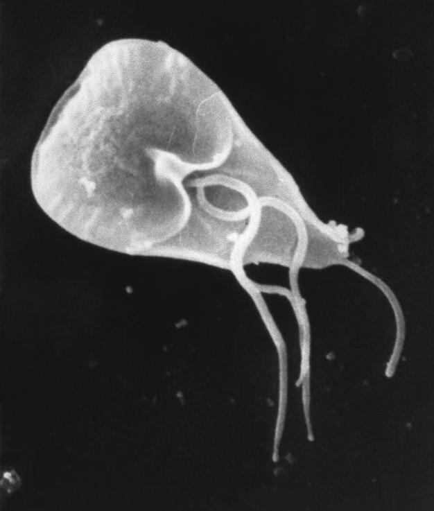 Giardiasis - Wikipedia