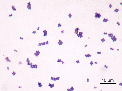 Staphylocoque doré — Wikipédia