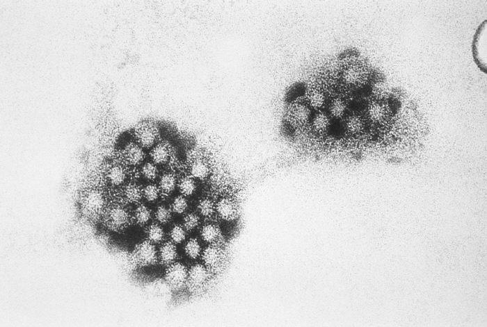 Norovirus — Wikipédia