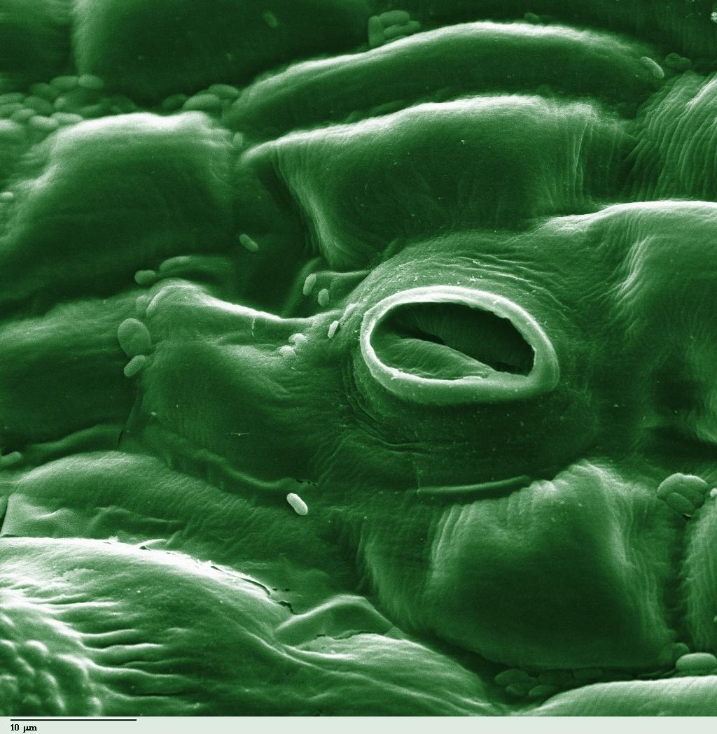 Stoma - Wikipedia