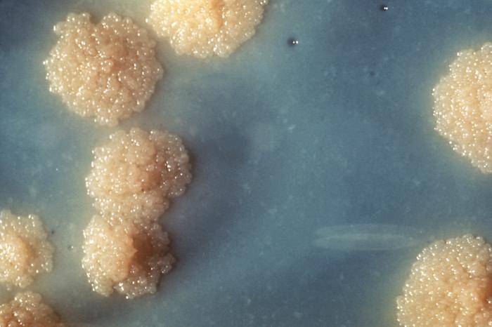 Mycobacterium tuberculosis - Wikipedia