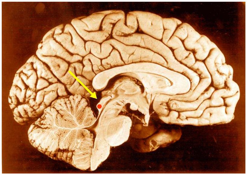 Inferior colliculus - Wikipedia