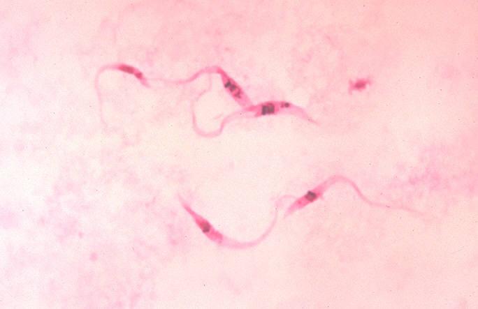 Trypanosomiasis - Wikipedia