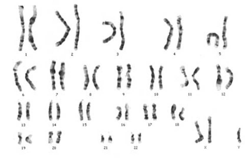 Neurogenetics - Wikipedia