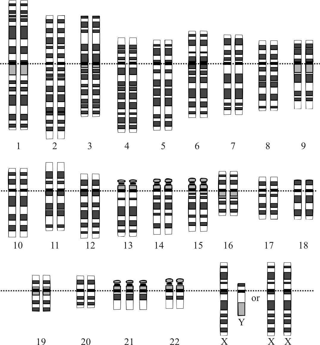 Aneuploidy - Wikipedia