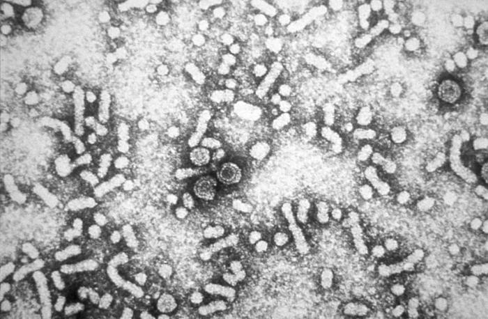 Hepatitis B - Wikipedia