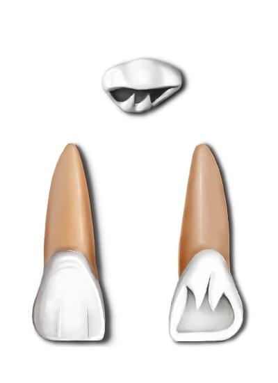 Maxillary central incisor - Wikipedia