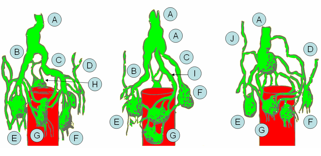 Thoracic duct - Wikipedia