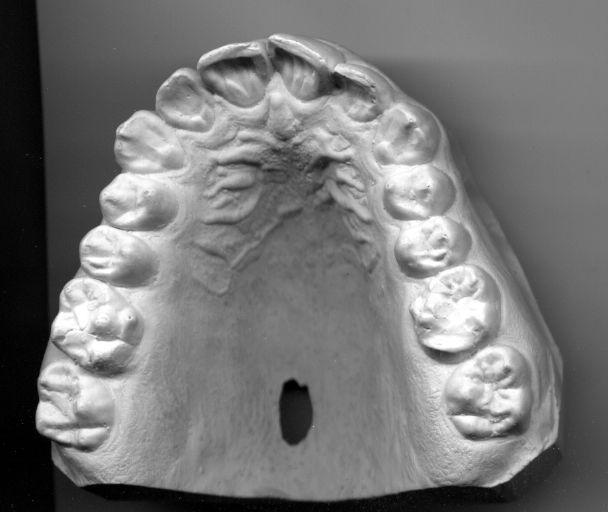 Dentition - Wikipedia