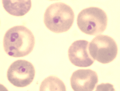 Plasmodium berghei - Wikipedia