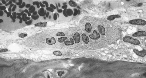 Osteoclast - Wikipedia