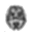 Tomographie par émission monophotonique — Wikipédia