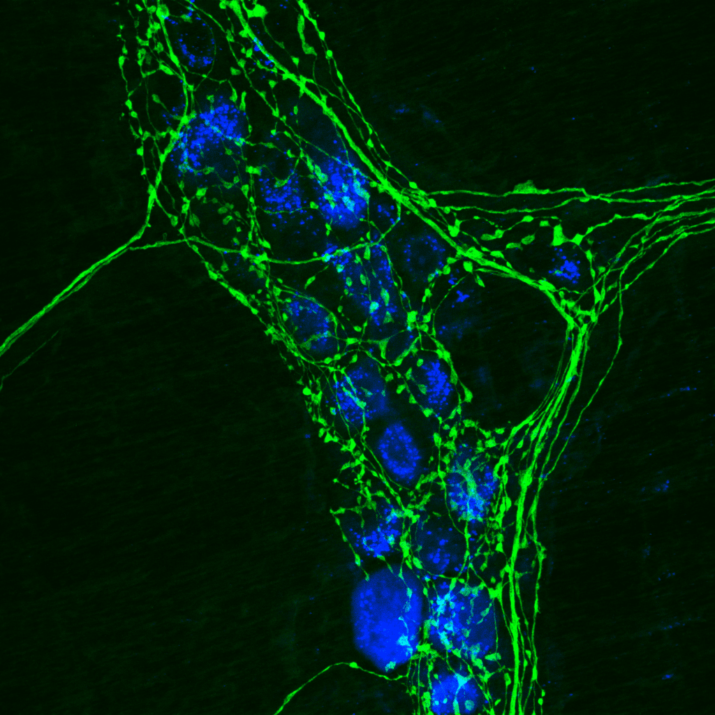 Immunohistochimie — Wikipédia