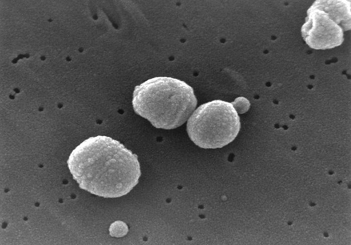 Streptococcus pneumoniae — Wikipédia