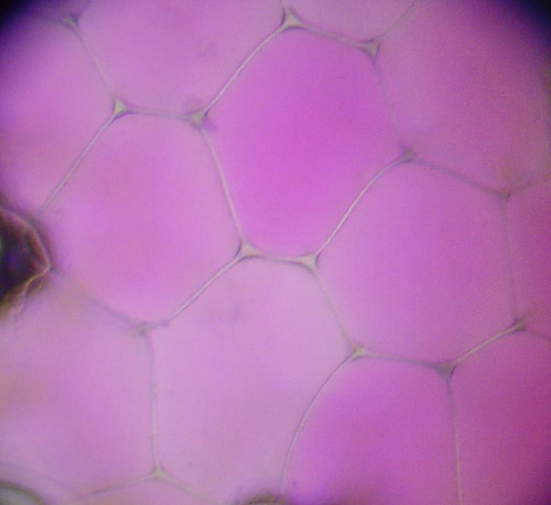 Plasmolyse — Wikipédia