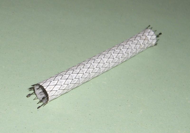 Stent — Wikipédia