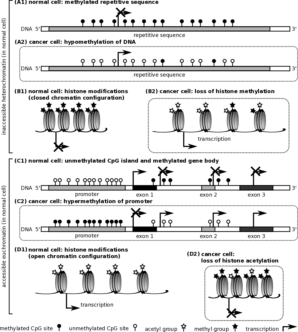 Cancer epigenetics - Wikipedia