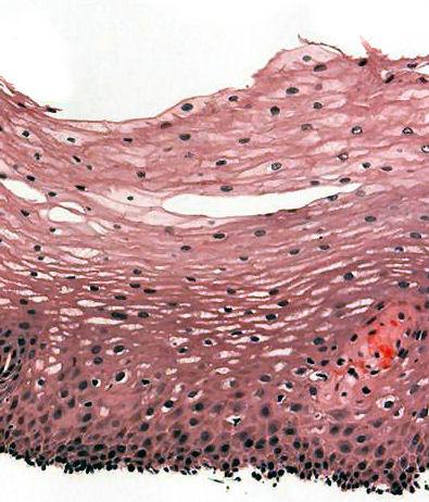 Stratified squamous epithelium - Wikipedia