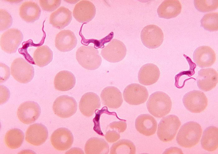 African trypanosomiasis - Wikipedia