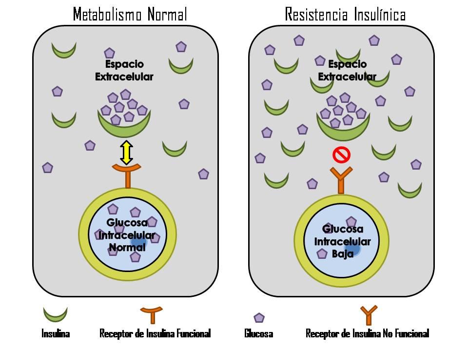 Résistance à l'insuline — Wikipédia