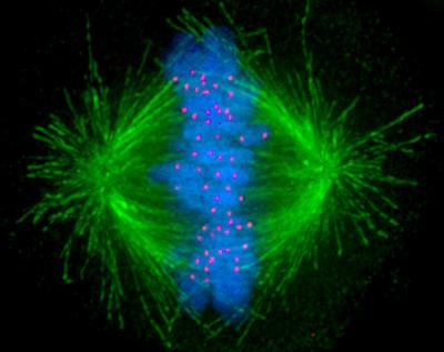 Kinetochore - Wikipedia