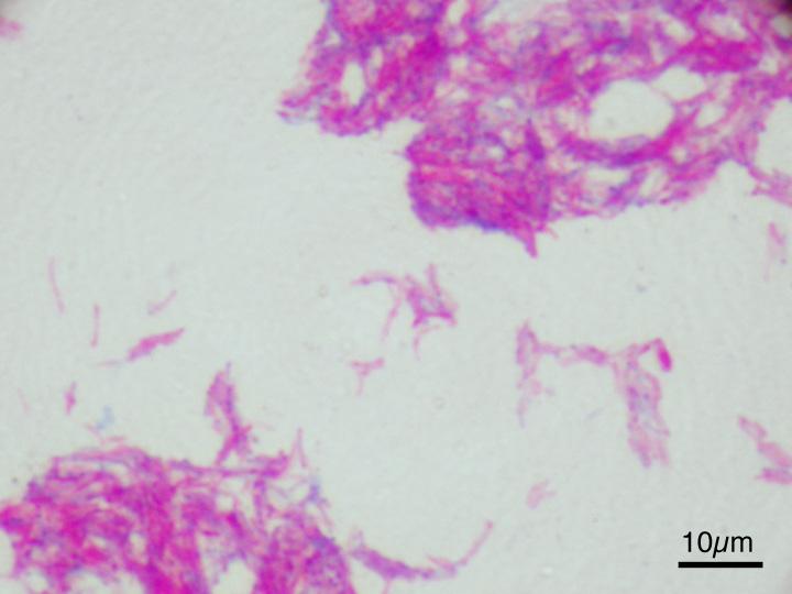 Mycobacterium tuberculosis var. bovis — Wikipédia