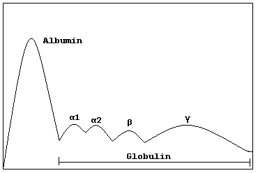 Gammapathie monoclonale de signification indéterminée — Wikipédia