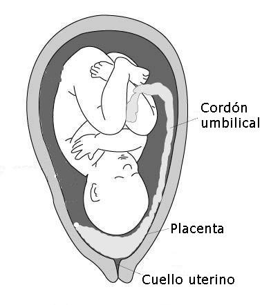 Placenta praevia - Wikipedia