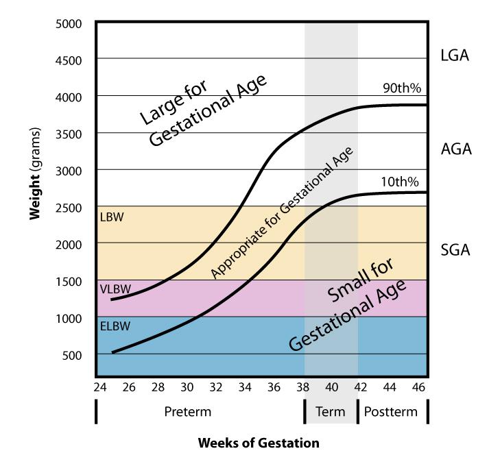 Small for gestational age - Wikipedia