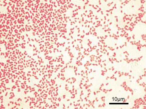 Gram-negative bacteria - Wikipedia