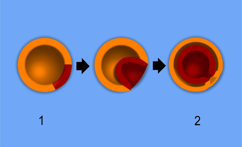 Embryology - Wikipedia