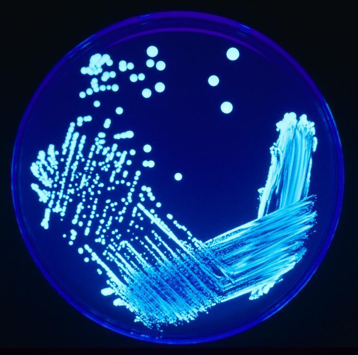 Legionella — Wikipédia