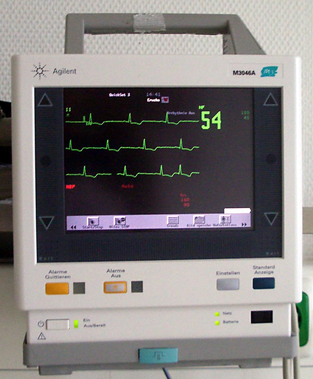 Monitoring (medicine) - Wikipedia