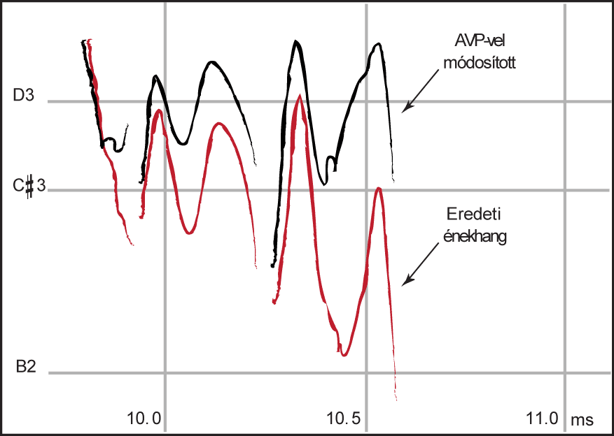 Correction de timbre — Wikipédia