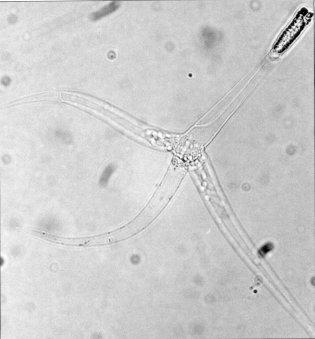 Myxozoa — Wikipédia