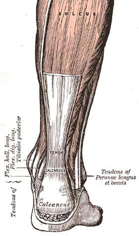 Tendinopathy - Wikipedia