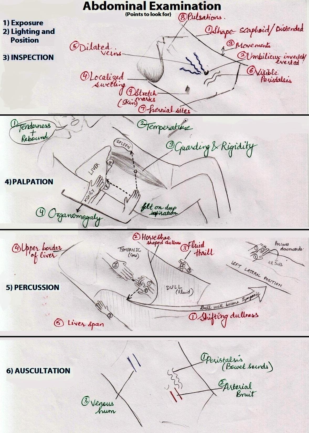 Abdominal examination - Wikipedia