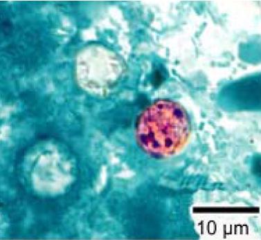 Cyclospora cayetanensis - Wikipedia