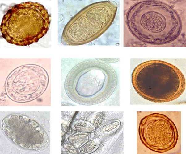 Parasitic worm - Wikipedia