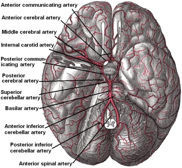 Cerebral hypoxia - Wikipedia