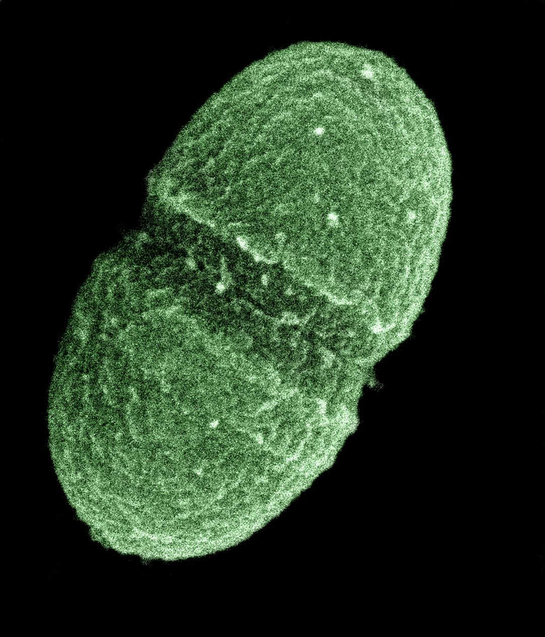 Enterococcus faecalis - Wikipedia