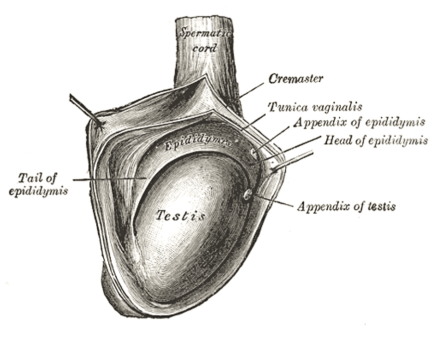 Hydrocele testis - Wikipedia