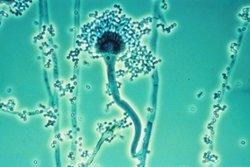 Aspergillus — Wikipédia