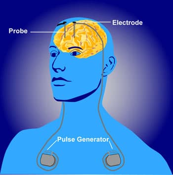 Neuroethics - Wikipedia