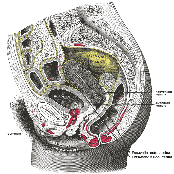 Rectocele - Wikipedia