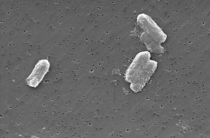 Enterobacteriaceae - Wikipedia