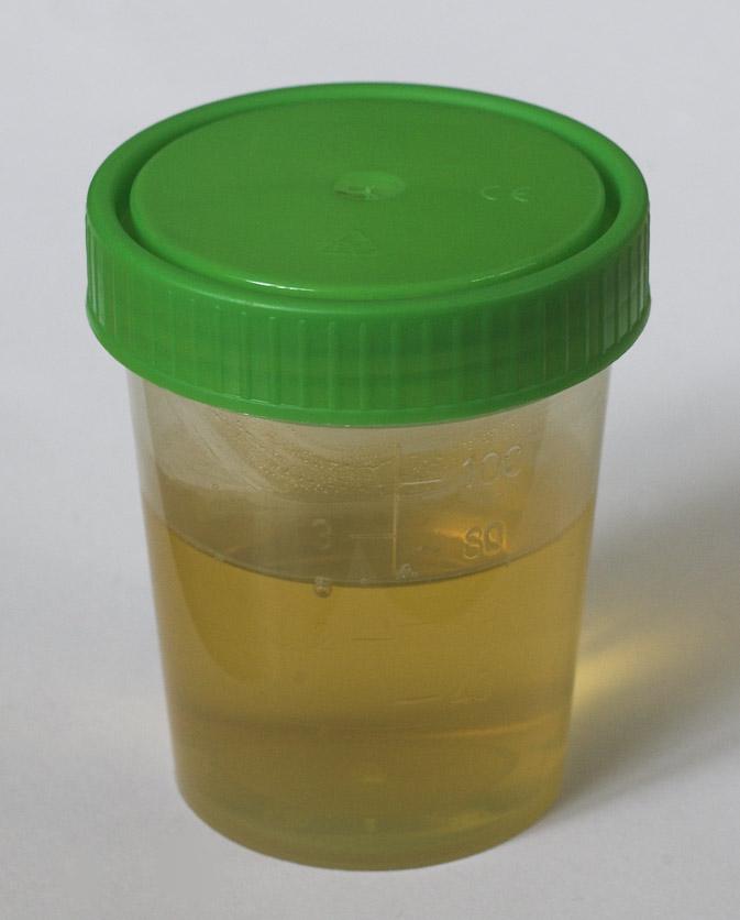 Urine — Wikipédia