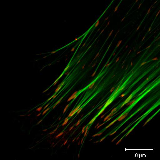 Focal adhesion - Wikipedia